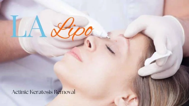 Woman receiving Actinic Keratosis Removal Treatment Tring