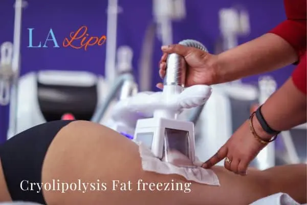 women getting fat freezing Tring