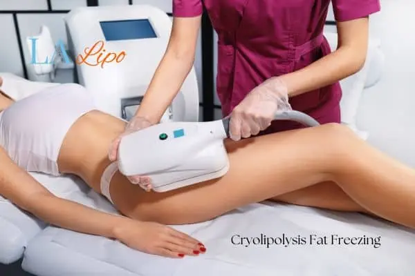 Woman receiving coolsculpting Tring treatment on her thighs