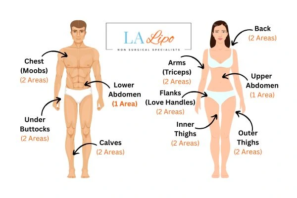 LA LIPO Cryolipolysis Areas Tring