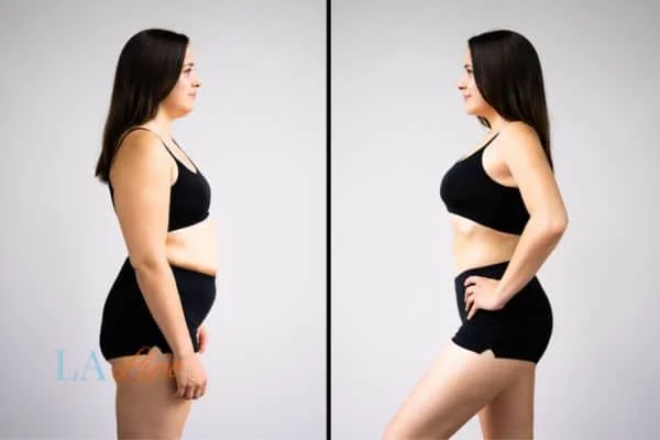 link between body image and mental health Tring