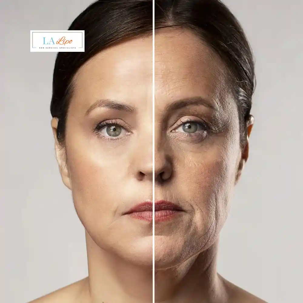 How Can You Tell If Non-Surgical Skin Tightening Is Right for You Tring?