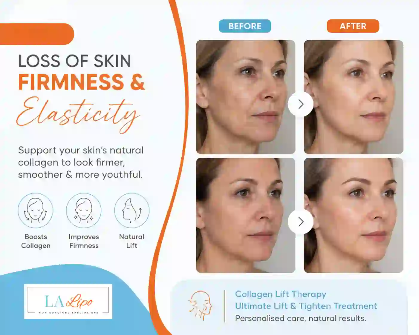 Sign #7: Loss of Skin Firmness and Elasticity Tring