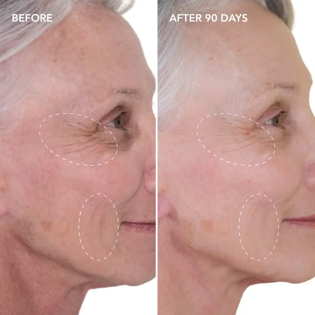 When will you see results Tring